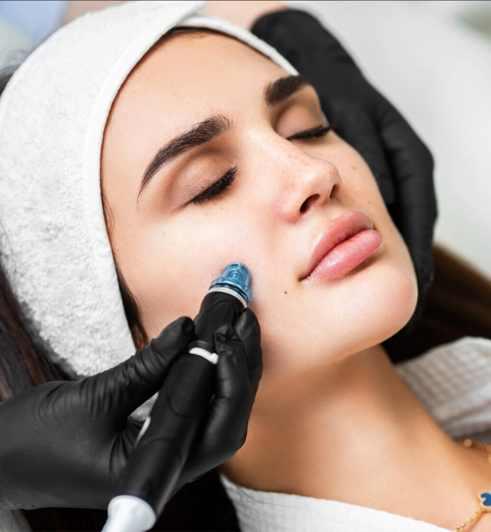 Deluxe Acne | Hydrafacial Syndeo