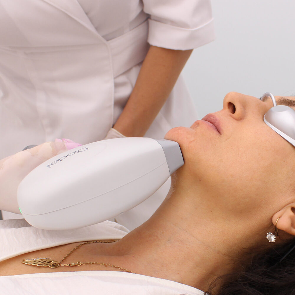 Брадичка - Prime Lase HR / лазерна епилация жени / Русе Prime Lase HR