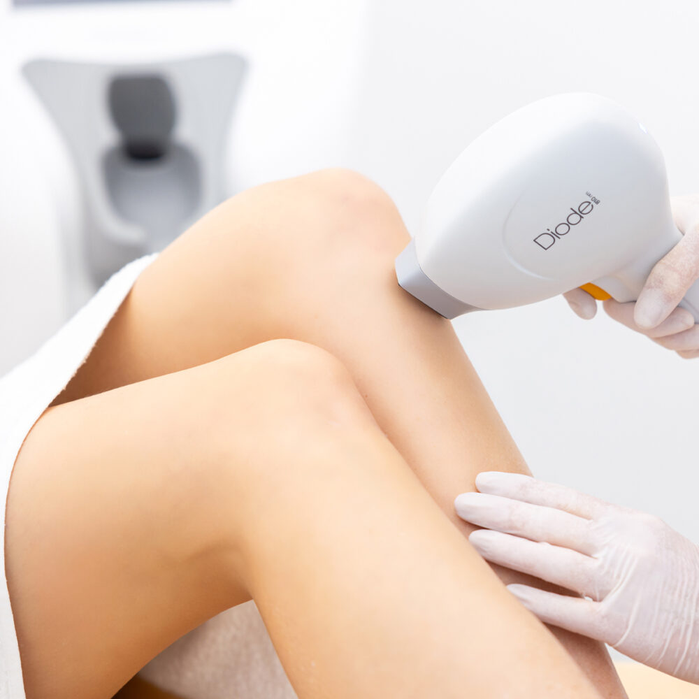 Крака - Prime Lase HR / лазерна епилация жени / Русе Prime Lase HR