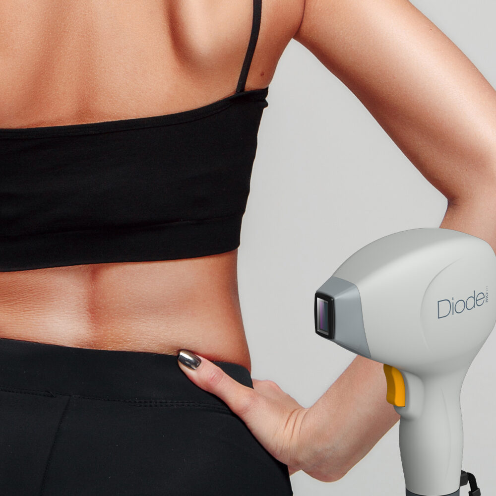 Кръст - Prime Lase HR / лазерна епилация жени / Русе Prime Lase HR