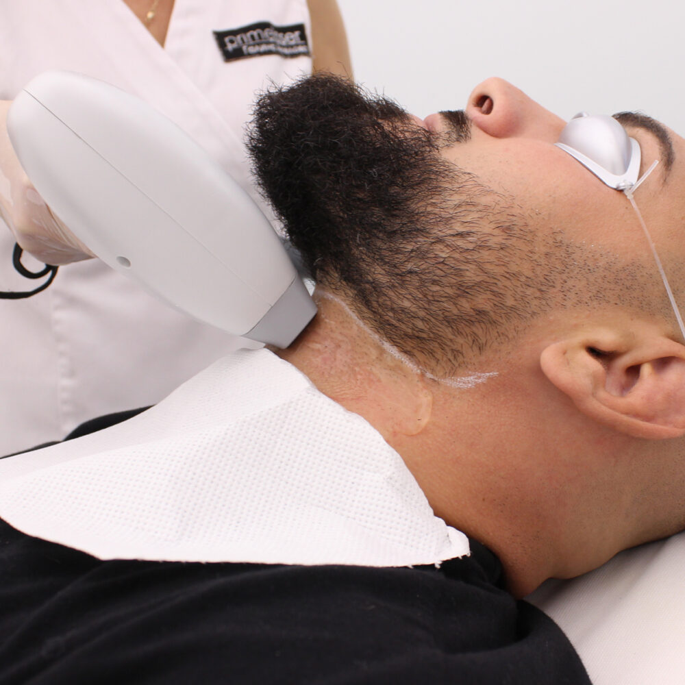 Линия брада - Prime Lase HR / лазерна епилация мъже / Русе Prime Lase HR