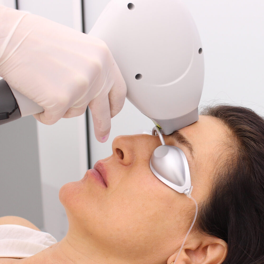 Междувеждие - Prime Lase HR / лазерна епилация жени / Русе Prime Lase HR