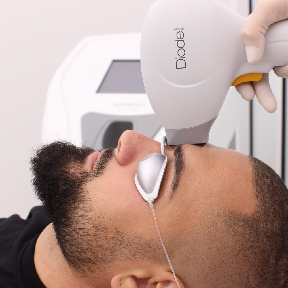 Междувеждие - Prime Lase HR / лазерна епилация мъже / Русе Prime Lase HR