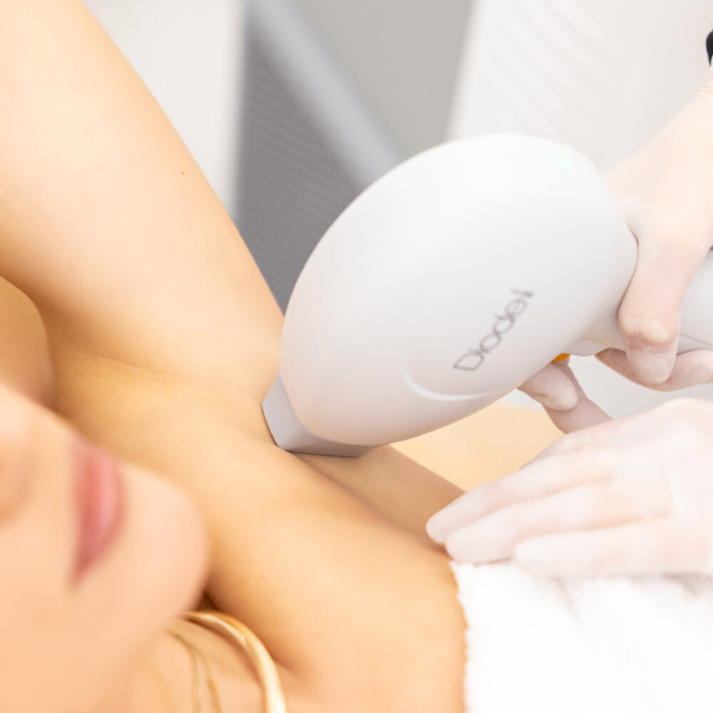 Подмишници - Prime Lase HR / лазерна епилация жени / Русе Prime Lase HR