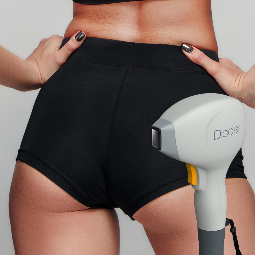 Седалище - Prime Lase HR / лазерна епилация жени / Русе Prime Lase HR