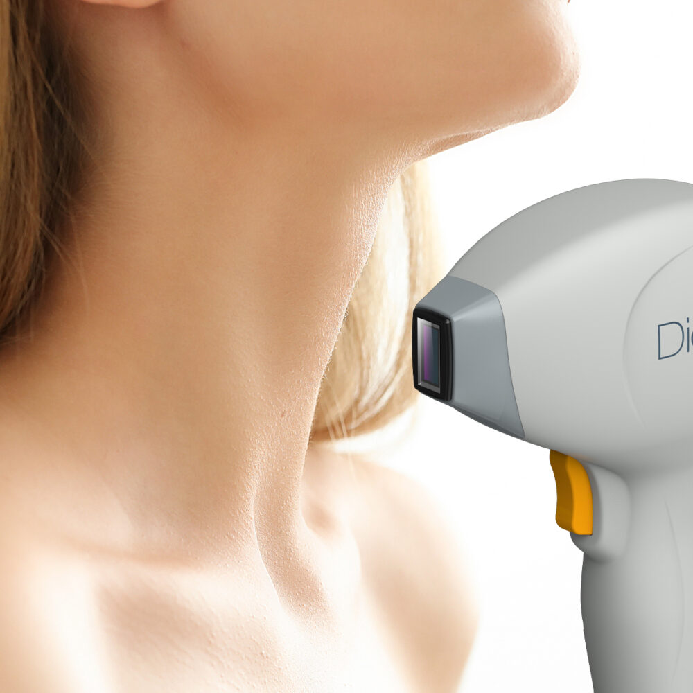 Шия - Prime Lase HR / лазерна епилация жени / Русе Prime Lase HR