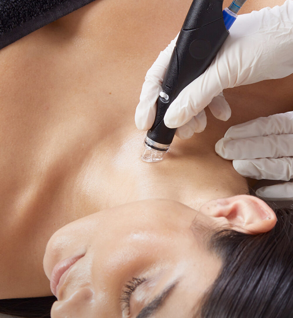 Шия и Деколте | Hydrafacial Syndeo